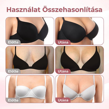🌟HISKIN® MELLEMELŐ ÉS FESZESÍTŐ MIKROTŰS TAPASZOK
