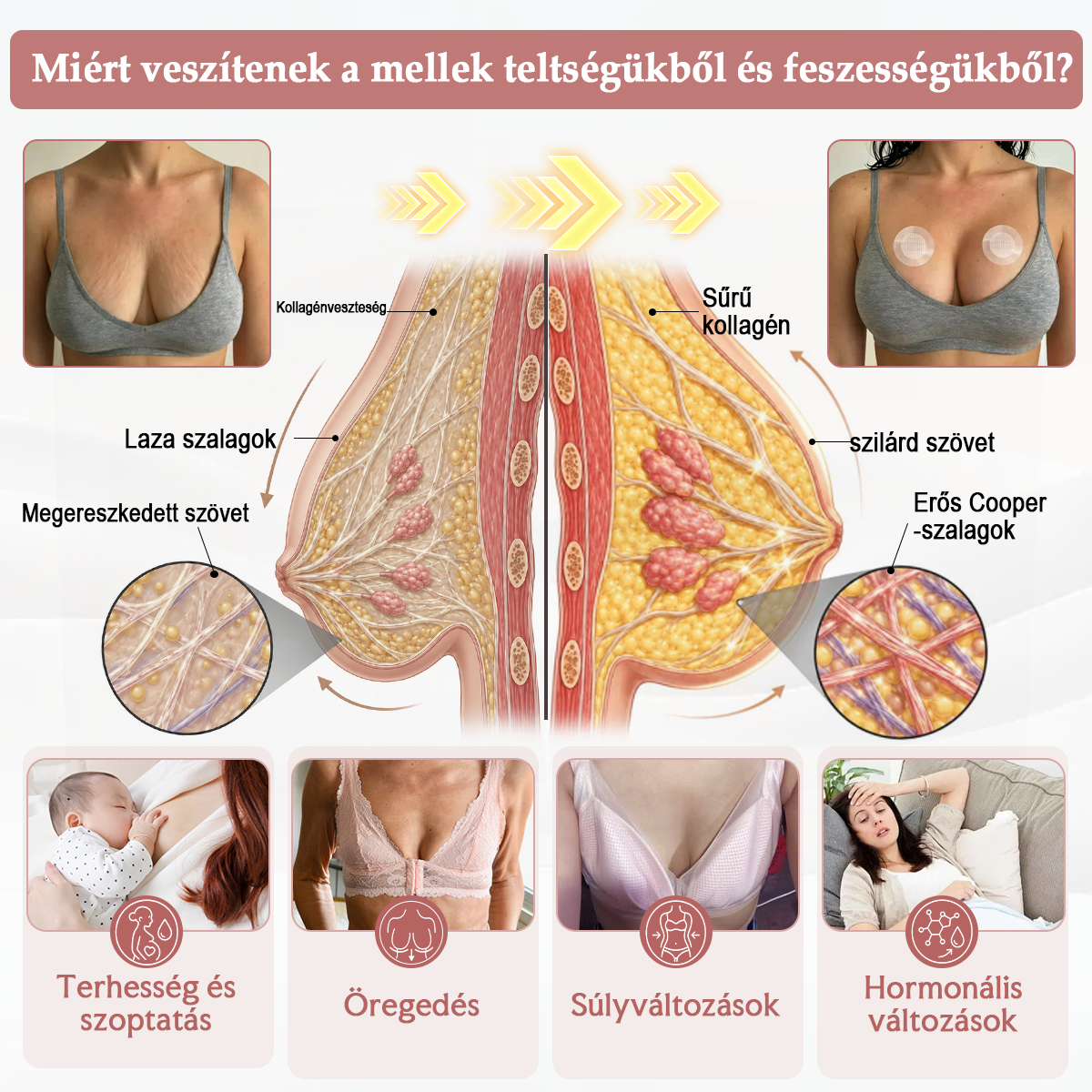 🌟HISKIN® MELLEMELŐ ÉS FESZESÍTŐ MIKROTŰS TAPASZOK