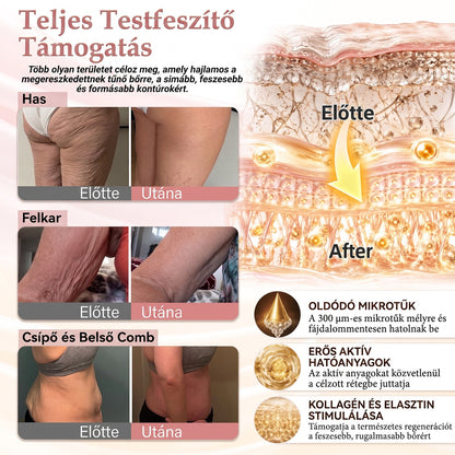 🌟HISKIN® MELLEMELŐ ÉS FESZESÍTŐ MIKROTŰS TAPASZOK