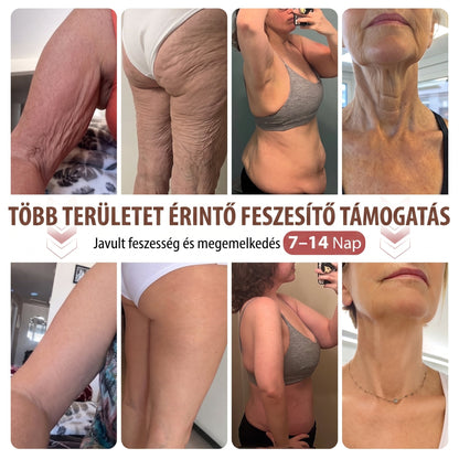 🌟HISKIN® MELLEMELŐ ÉS FESZESÍTŐ MIKROTŰS TAPASZOK